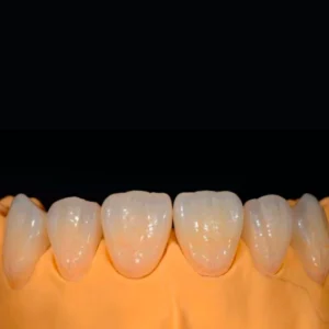 All-ceramic series (CAD/CAM, Aiertron, Weiland, Zekang and other brands)