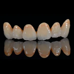 3D printed digital bio-porcelain teeth